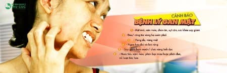 benh-gan-mat-thuong-de-nang-moi-di-kham