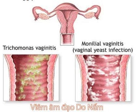 benh-phu-khoa-mua-he-cho-voi-chu-quan1