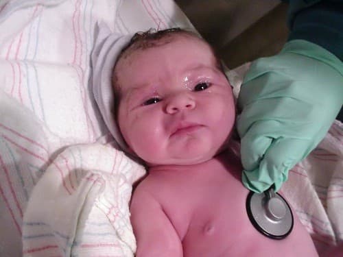 Tắc tuyến lệ là tình trạng hệ thống thoát nước ở vùng mắt của trẻ bị chặn, do đó những giọt nước mắt không thể thoát ra ngoài, khiến cho đôi mắt trẻ bị ngập nước. 