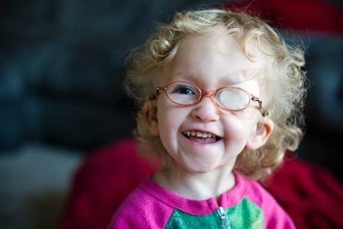 Mắt lười hay mắt nhược thị (Amblyopia) là tình trạng thị lực ở một mắt phát triển không bình thường, khiến thị lực suy giảm. 