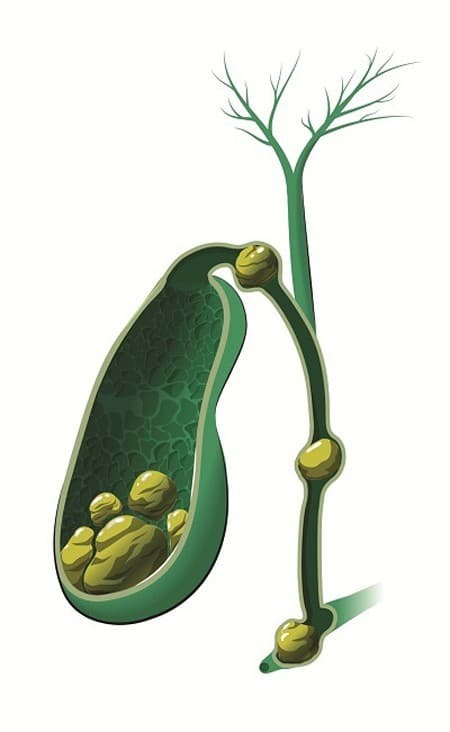 de-mac-cac-benh-gan-mat-sau-tuoi-50.1jpg