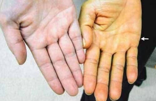 hoi-dap-ve-benh-soi-mat.jpg2