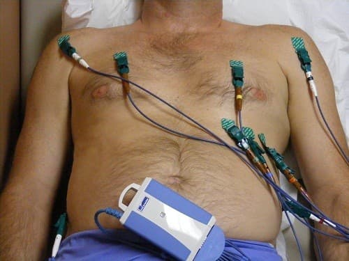 Bác sĩ sẽ yêu cầu thực hiện thêm một số xét nghiệm khác như chụp X quang tim phổi, siêu âm tim và điện tâm đồ để xác định nguyên nhân gây khó thở khi nằm xuống.