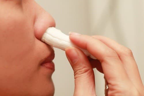 Một trong những triệu chứng thường gặp của bệnh von Willebrand là chảy máu mũi.