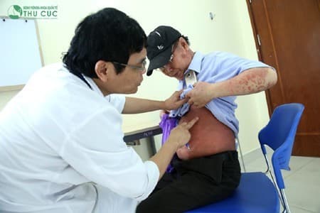 viem-gan-b-va-nhung-huy-hoai-dang-so1