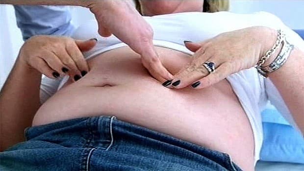 Xét nghiệm ung thư dạ dày