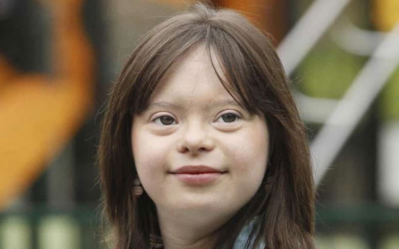 Hội chứng Down là một bệnh do rối loạn nhiễm sắc thể, thường xuất hiện trong thai kỳ, nguyên nhân chính là do thai nhi bị thừa nhiễm sắc thể.