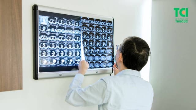 Chữa ung thư: Phác đồ điều trị quyết định phần thắng