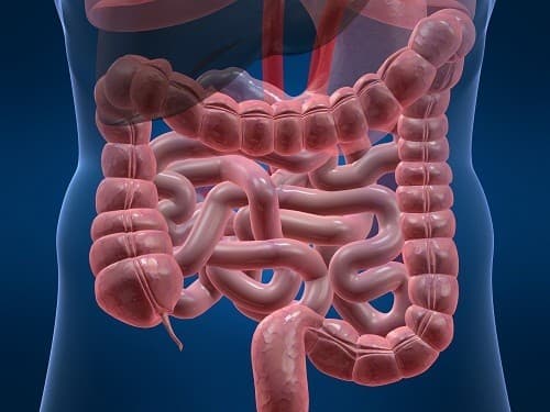 Bệnh Crohn - đặc trưng bởi tình trạng viêm mạn tính của ruột, cũng có thể là nguyên nhân gây rò hậu môn.