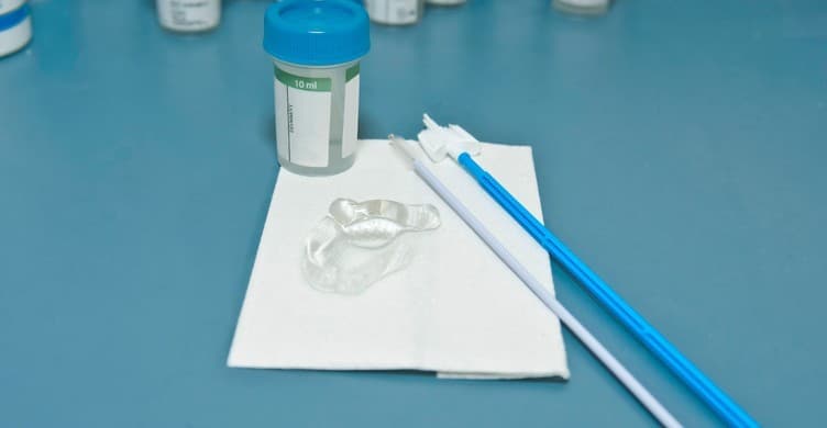 Xét nghiệm Pap được khuyến khích thực hiện cho phụ nữ từ 21 tuổi trở lên.