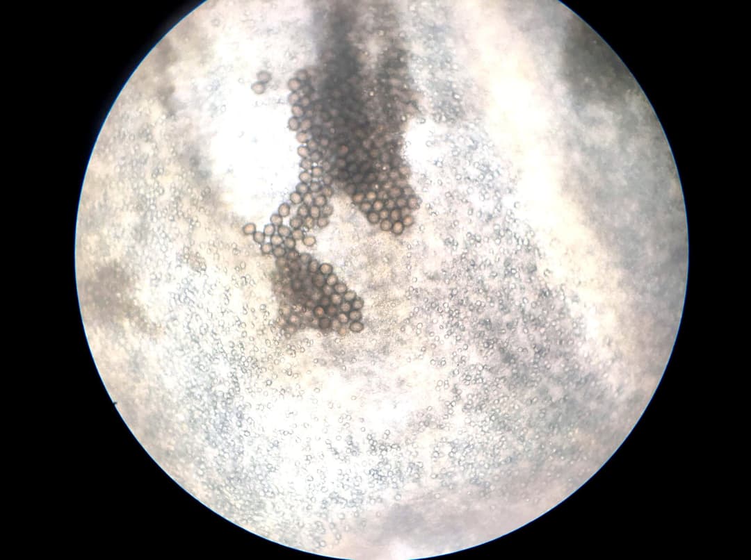 phat-hien-nhiem-au-trung-san-lon-do-an-tiet-canh