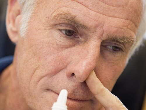 Để giảm bớt các triệu chứng khó chịu của viêm xoang mạn tính, người bệnh có thể được chỉ định điều trị bằng một số loại thuốc.