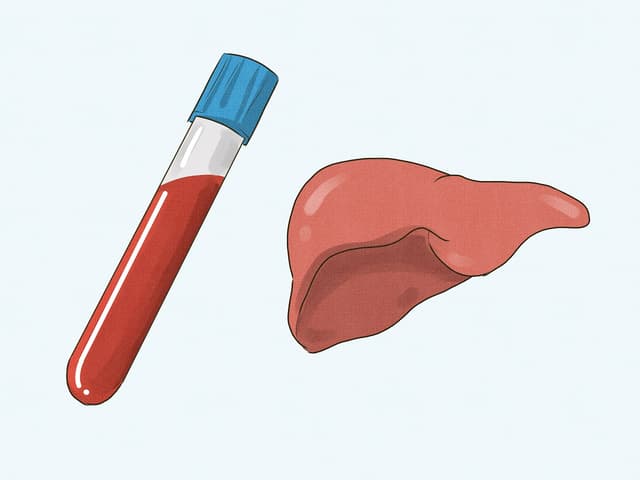 Xét nghiệm Gamma GT là gì?