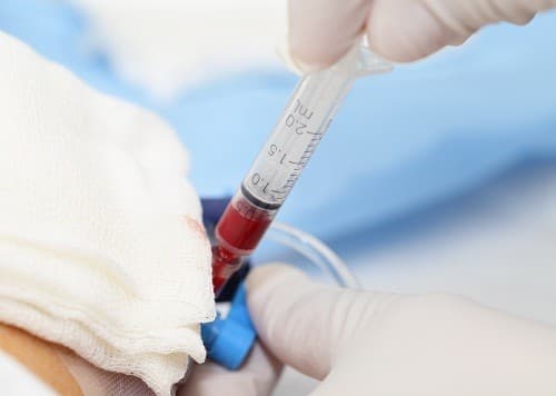 xét nghiệm LHD xác định bệnh