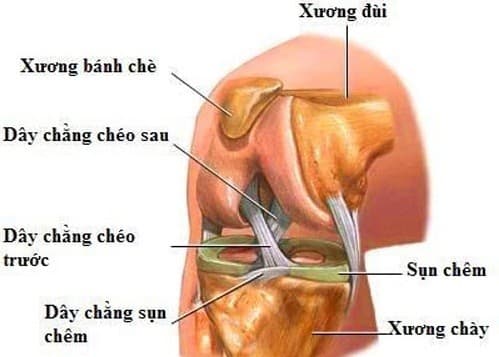 Khi đầu gối bị chấn thương có thể là do giãn dây chằng hoặc rách/ rạn sụn chêm đầu gối