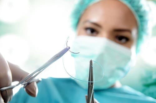 Có hai phương pháp mổ viêm ruột thừa là: mổ mở và nội soi.