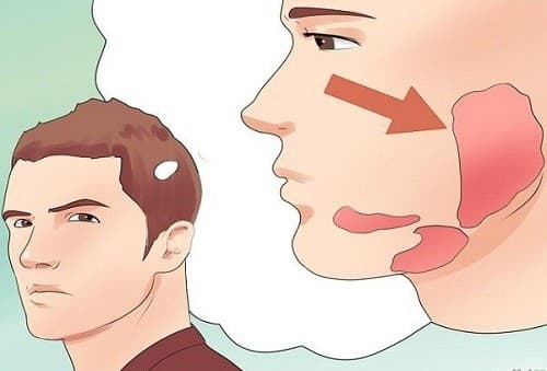 Bệnh quai bị có lây không? phòng ngừa nguy cơ