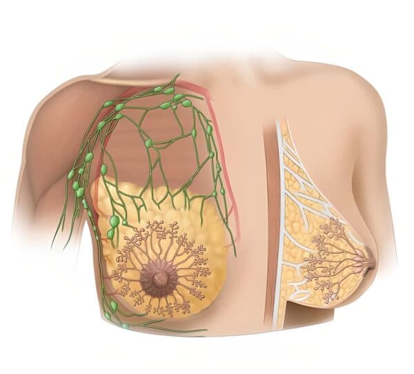 Sự tăng nồng độ estrogen có thể liên quan đến sự phát triển u nang tuyến vú