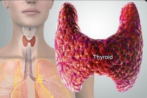 Viêm tuyến giáp là bệnh tổn thương tuyến giáp do nhiễm vi khuẩn, virus, thuốc hoặc miễn dịch…