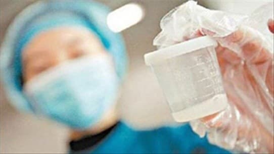 Tinh trùng trước khi bơm vào tử cung cần phải được tiến hành lọc rửa