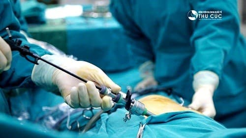 Phẫu thuật điều trị buồng trứng đa nang tại Bệnh viện Thu Cúc được tiến hành nhanh chóng, chuyên nghiệp. 