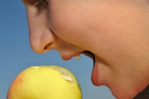 Hội chứng dị ứng đường miệng hay còn gọi là dị ứng với phấn hoa quả, xảy ra khi một người bị dị ứng phấn hoa và sau đó ăn một loại trái cây có chứa protein tương tự với phấn hoa.