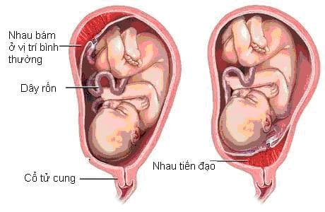 Nhau tiền đạo nguy hiểm như thế nào là vấn đề được rất nhiều người quan tâm.
