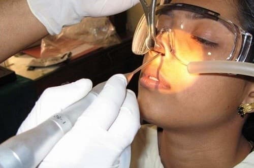 phau-thuat-polyp-mui-co-bien-chung