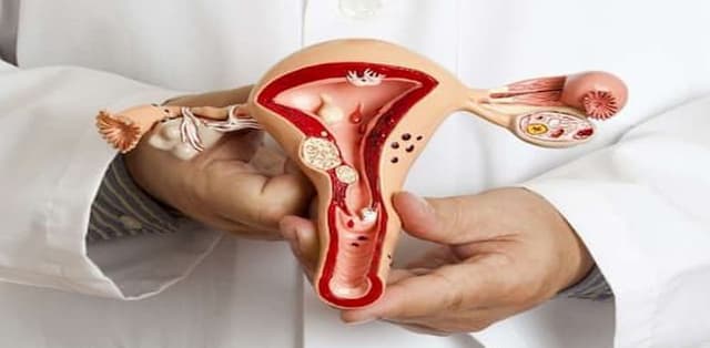 Tìm hiểu về tắc vòi trứng là bệnh thường gặp ở những phụ nữ 