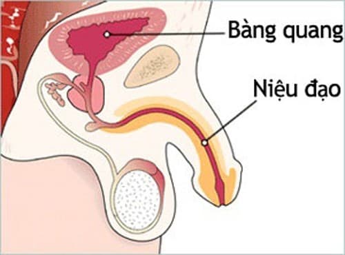 Viêm niệu đạo là bệnh thường gặp ở nam giới tuổi trưởng thành do nhiều nguyên nhân khác nhau, trong đó do vi khuẩn.