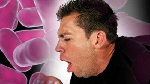 Khi bị giãn phế quản, người bệnh sẽ thấy xuất hiện các triệu chứng như ho mạn tính, đờm mủ xuất tiết nhiều, ho ra máu và viêm phổi tái đi tái lại...