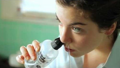 Sau khi mổ polyp mũi cần vệ sinh mũi hàng ngày bằng nước muối sinh lý