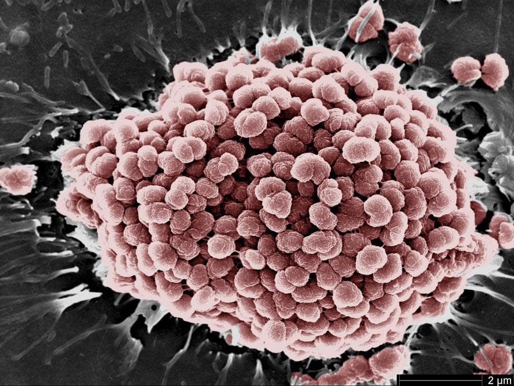 nhung-benh-xa-hoi-thuong-gap