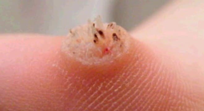 nhung-benh-xa-hoi-thuong-gap3