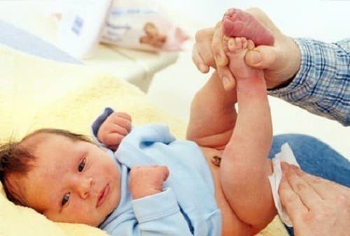 Để phòng viêm tiết niệu cho trẻ cha mẹ cần chú ý vệ sinh cá nhân, thay tã cho trẻ thường xuyên