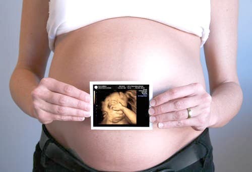 Không nên lạm dụng siêu âm 4D bởi nó có thể gây ảnh hưởng tới mắt hoặc tuyến sinh dục của trẻ