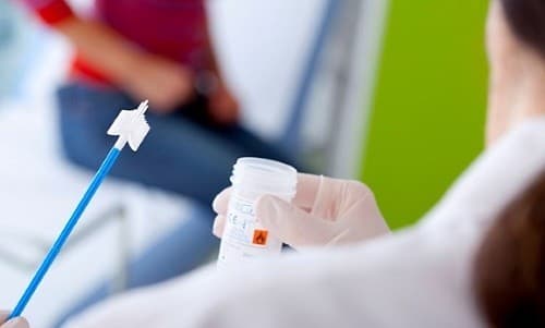 Những câu hỏi thường gặp về xét nghiệm Pap smear