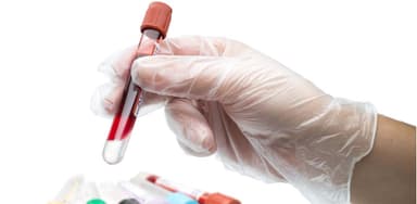 Xét nghiệm CA 19-9 và những điều cần biết