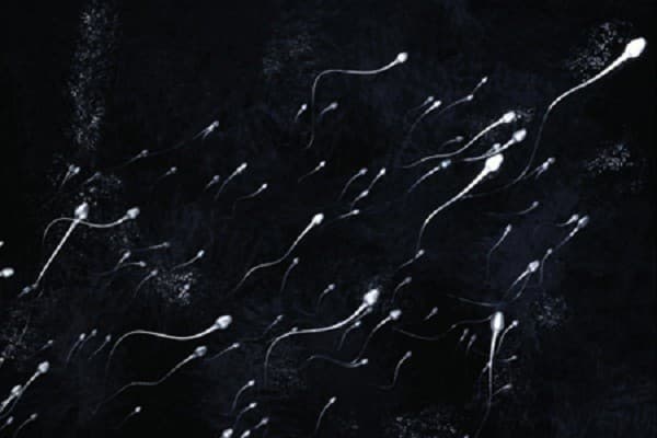 Tinh trùng yếu có thể hạn chế khả năng sinh sản của nam giới