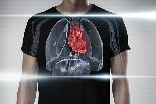 Tràn dịch màng ngoài tim là tình trạng xuất hiện dịch bất thường hoặc những chất tương tự như dịch trong khoang màng ngoài tim. 