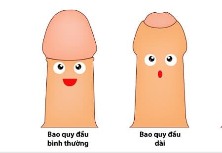 Những bệnh nam khoa thường gặp