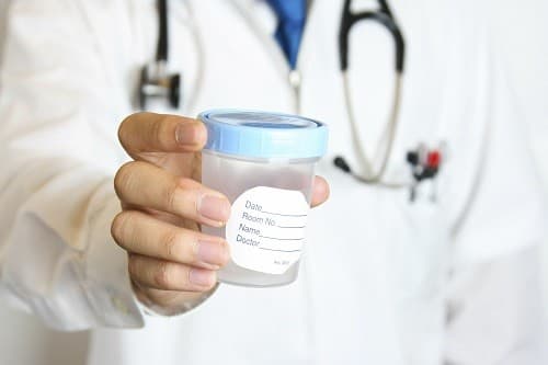 Những người được yêu cầu thực hiện xét nghiệm nước tiểu sẽ nhận được một lọ nhỏ có dán tên, ngày tháng để thu thập mẫu nước tiểu.