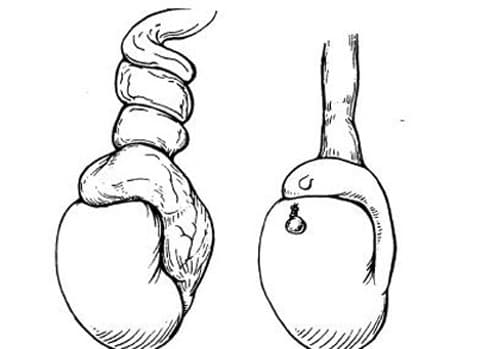 xoan-tinh-hoan-nguy-hiem-nhu-the-nao2