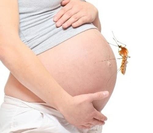 1479176487_virus-zikajpg