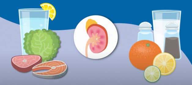 Bổ sung vitamin C không đúng cách dễ gây sỏi thận