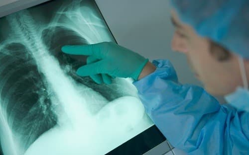 Nếu bị ho khan kéo dài hơn một tuần hoặc lâu hơn nên tới bệnh viện để kiểm tra, đặc biệt nếu tình trạng này ngày càng trở nên tồi tệ hoặc không thể xác định rõ nguyên nhân