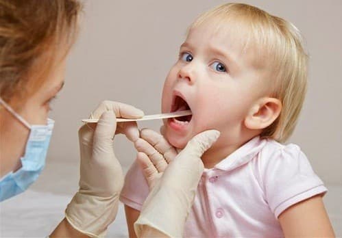 Bạn nên đến cơ sở chuyên khoa để được thăm khám và điều trị khi có dấu hiệu viêm VA