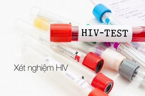 Báo động tình trạng trẻ nhiễm HIV