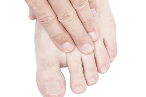 Tê ở ngón chân cái do những bất thường nào