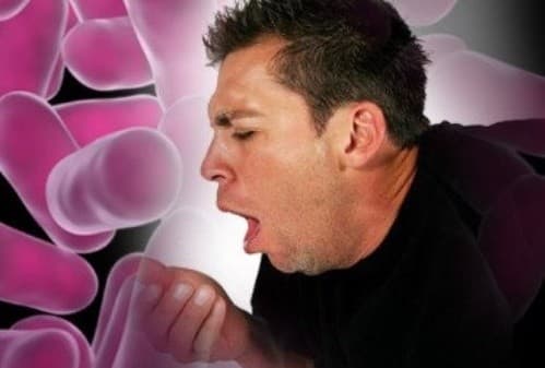 Viêm phổi thường gây ra bởi hiện tượng nhiễm trùng do nhiều tác nhân như virus, vi khuẩn, nấm và các vi sinh vật khác như ký sinh trùng.